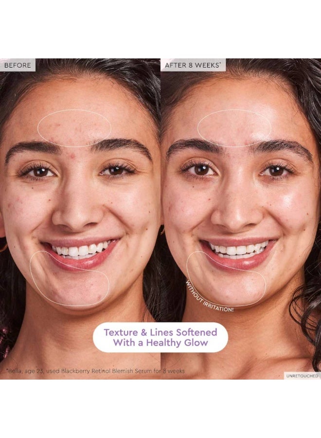 GLOW RECIPE Blackberry Retinol Blemish Serum 30ml - Image 4